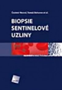 Biopsie sentinelov&#233; uzliny