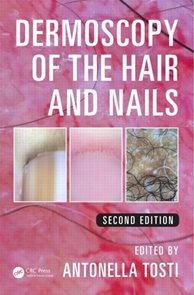 Dermoscopy of the Hair and Nails 2nd Edition