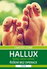 Hallux - Řešení bez operace