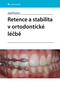 Retence a stabilita v ortodontick&#233; l&#233;čbě