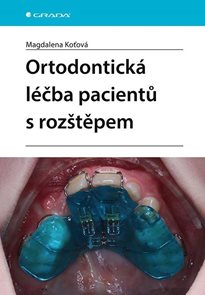 Ortodontick&#225; l&#233;čba pacientů s rozštěpem