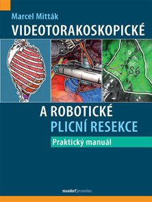 Videotorakoskopick&#233; a robotick&#233; plicn&#237; resekce
